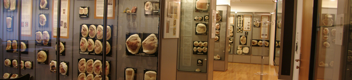 Moulagenmuseum